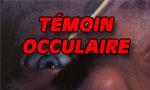 Témoin occulaire